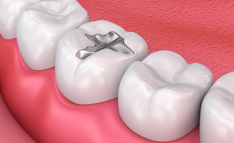 dental feeling in malviya nagar, jaipur