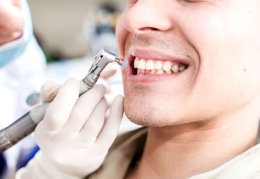 teeth cleaning in malviya nagar, jaipur